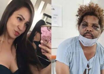 Caso Mendigo: Laudo aponta transtorno psicótico de mulher que saiu com morador de rua no DF