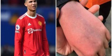 Jovem que teve celular quebrado por Cristiano Ronaldo é autista e ficou em choque, diz mãe; CR7 será ouvido pela polícia