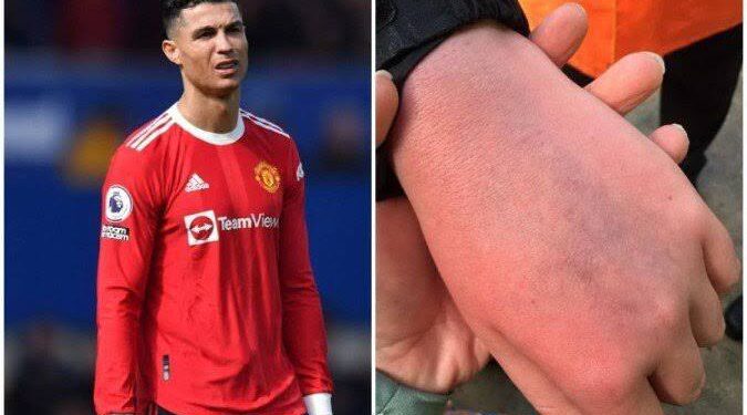 Jovem que teve celular quebrado por Cristiano Ronaldo é autista e ficou em choque, diz mãe; CR7 será ouvido pela polícia