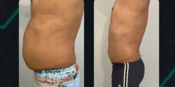 Crio do Nil: Conheça o método que está mudando o jeito de fazer estética no Maranhão