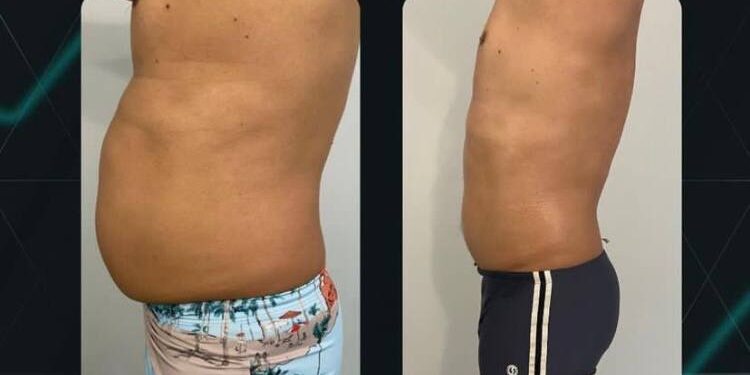 Crio do Nil: Conheça o método que está mudando o jeito de fazer estética no Maranhão Crio do Nil: Conheça o método que está mudando o jeito de fazer estética no Maranhão