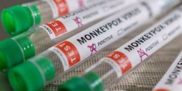 Saúde: Maranhão registra seis novos casos de varíola dos macacos