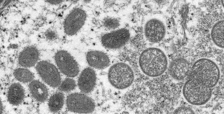 Saúde: Infectologista alerta para avanço da varíola dos macacos e cita grupos suscetíveis a casos graves